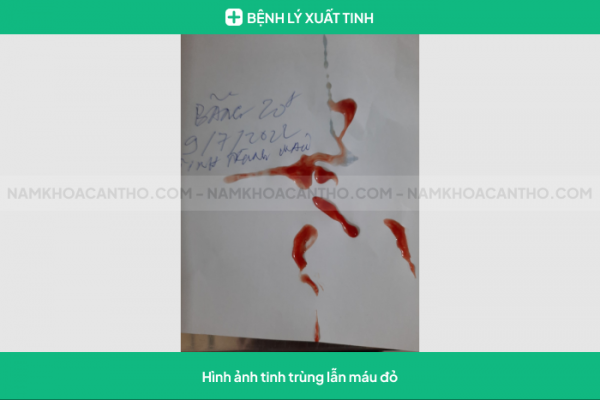 Xuất tinh ra máu